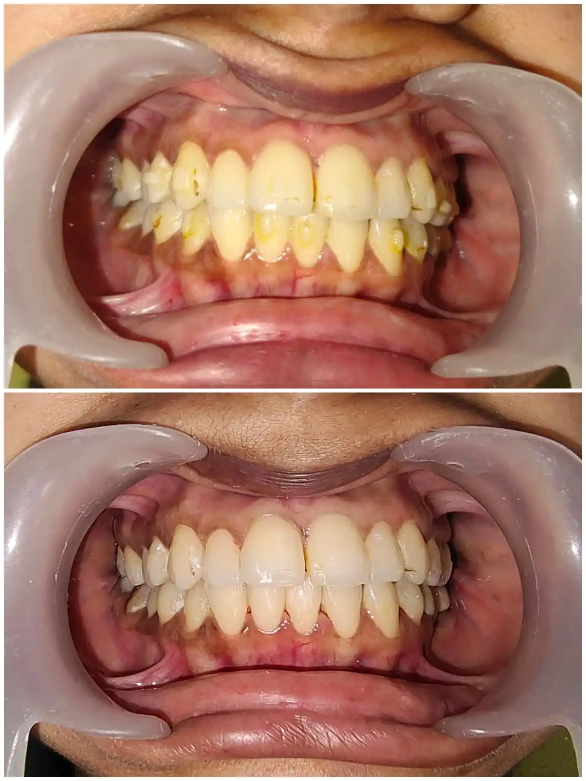 The Dental Zone Image 1